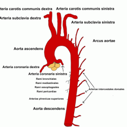 Aorta thoracic disease