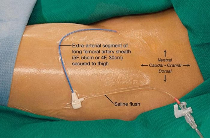 Groin adductor muscle tendon flexor hips tear bodyworks spondylolisthesis sore organs hamstring flexors ift tt 2000