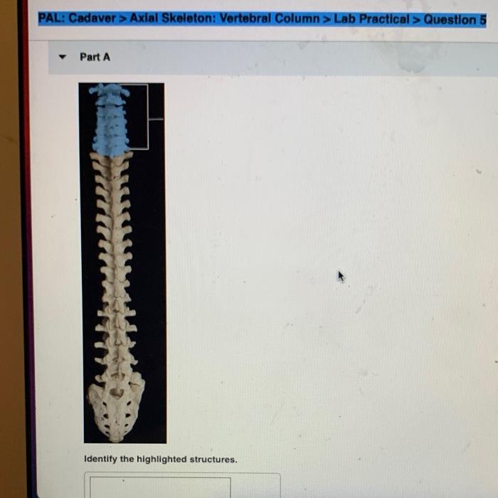 Pal cadaver axial skeleton vertebral column lab practical question 5